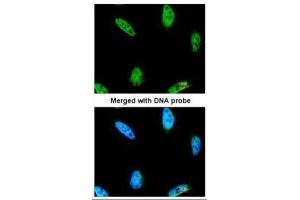 ICC/IF Image Immunofluorescence analysis of paraformaldehyde-fixed HeLa, using IPMK, antibody at 1:200 dilution.