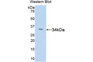Western Blotting (WB) image for anti-Tissue Factor Pathway Inhibitor (Lipoprotein-Associated Coagulation Inhibitor) (TFPI) (AA 29-302) antibody (ABIN1078584) (TFPI anticorps  (AA 29-302))