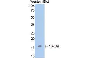 Western blot analysis of the recombinant protein. (TPSAB1 anticorps  (AA 149-273))