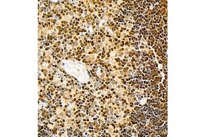 Immunohistochemistry of paraffin embedded rat kidney using TCF7 (ABIN7075952) at dilution of 1:600 (400x lens)