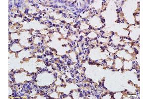 Formalin-fixed and paraffin embedded rat lung tissue labeled with Anti-FBP1 Polyclonal Antibody, Unconjugated  at 1:200 followed by conjugation to the secondary antibody (FBP1 anticorps  (AA 31-130))