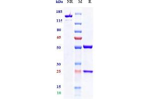 Anti-TIGIT Reference Antibody (vibostolimab) on SDS-PAGE under reducing (R) condition. (Recombinant TIGIT (Vibostolimab Biosimilar) anticorps)