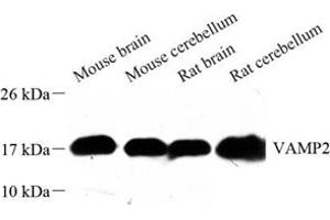 Western blot analysis of VAMP2 (ABIN7076197) at dilution of 1: 500 (VAMP2 anticorps)