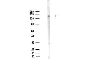 Western blot analysis of lysates from HUVEC cells(UV,30 min treatment), using Phospho-TrkA (Tyr680+Tyr681) Antibody at 1/1000 dilution.