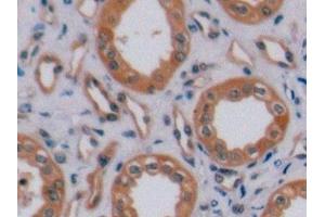 Detection of ErbB2 in Human Kidney Tissue using Polyclonal Antibody to Receptor Tyrosine Protein Kinase erbB-2 (ErbB2)