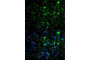 Immunofluorescence analysis of A-549 cells using SMYD4 antibody (ABIN6133038, ABIN6148171, ABIN6148172 and ABIN6223147). (SMYD4 anticorps  (AA 1-260))