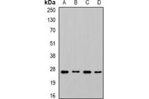 Western blot analysis of CHMP1B expression in MCF7 (A), SKOV3 (B), mouse liver (C), mouse brain (D) whole cell lysates. (CHMP1B anticorps)