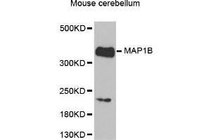 Western Blotting (WB) image for anti-Microtubule-Associated Protein 1B (MAP1B) (AA 1820-2100) antibody (ABIN1680748)