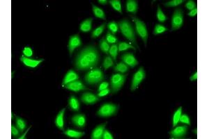Immunofluorescence analysis of MCF7 cells using SPDEF antibody (ABIN6132572, ABIN6148332, ABIN6148334 and ABIN6218364).