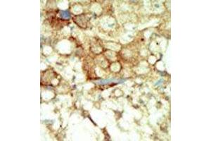 Image no. 2 for anti-Ret Proto-Oncogene (RET) (C-Term) antibody (ABIN359927) (Ret Proto-Oncogene anticorps  (C-Term))