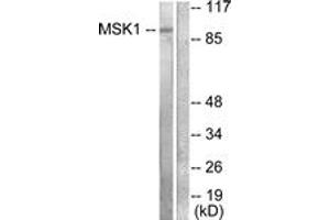 Western blot analysis of extracts from 293 cells, treated with UV 15', using MSK1 (Ab-581) Antibody. (MSK1 anticorps  (AA 551-600))