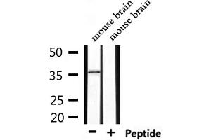 Western blot analysis of extracts from mouse brain, using ERCC1 Antibody.