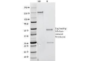 SDS-PAGE Analysis Purified IFNG Mouse Monoclonal Antibody (G-23). (Interferon gamma anticorps)