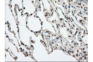 Image no. 9 for anti-Acetyl-CoA Acetyltransferase 2 (ACAT2) antibody (ABIN1496398)