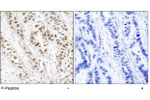 Image no. 1 for anti-Breast Cancer 1 (BRCA1) (pSer1524) antibody (ABIN196816) (BRCA1 anticorps  (pSer1524))
