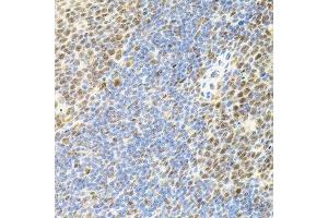 Immunohistochemistry of paraffin-embedded mouse spleen using EIF4G2 antibody.