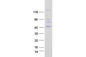 Validation with Western Blot