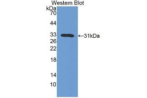 Western blot analysis of the recombinant protein. (IL7R anticorps  (AA 1-239))