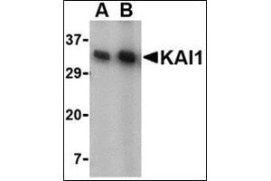 Western blot analysis of KAI1 in A549 cell lysate with this product at (A) 0. (CD82 anticorps  (C-Term))