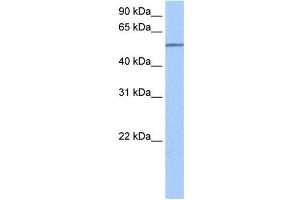 SEMA6D antibody used at 0. (SEMA6D anticorps  (N-Term))