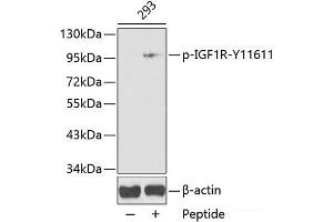Western blot analysis of extracts from 293 cells using Phospho-IGF1R(Y1161) Polyclonal Antibody. (IGF1R anticorps  (pTyr1161))
