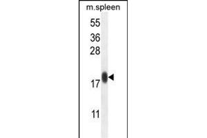IP1L Antibody (C-term) (ABIN654790 and ABIN2844468) western blot analysis in mouse spleen tissue lysates (35 μg/lane). (IMMP1L anticorps  (C-Term))