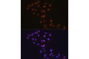 Immunofluorescence analysis of C6 cells using DNMT1 antibody (ABIN7266808).