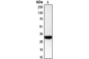 Western blot analysis of CDK2 expression in Jurkat (A) whole cell lysates. (CDK2 anticorps  (C-Term))