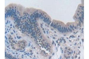 Detection of IL2 in Mouse Uterus Tissue using Polyclonal Antibody to Interleukin 2 (IL2) (IL-2 anticorps  (AA 10-169))
