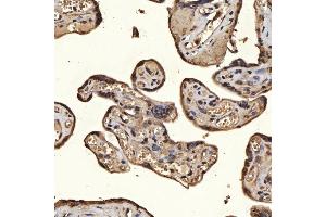 IHC analysis of SNRPA1 using anti-SNRPA1 antibody (ABIN7599131).