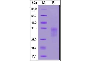Biotinylated Human CD7, His,Avitag on  under reducing (R) condition.