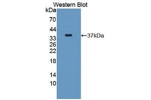 Western blot analysis of the recombinant protein. (GAN anticorps  (AA 30-326))