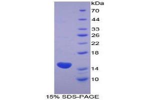 SDS-PAGE (SDS) image for Keratin 1 (KRT1) (AA 487-644) protein (His tag) (ABIN1980749) (Cytokeratin 1 Protein (AA 487-644) (His tag))