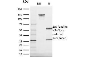 SDS-PAGE Analysis Purified Cytokeratin 20 (KRT20) Mouse Monoclonal Antibody (KRT20/1991). (KRT20 anticorps  (AA 196-323))