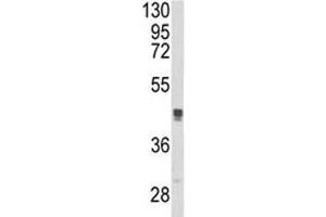Western blot analysis of TGN46 antibody and MCF-7 lysate. (TGOLN2 anticorps  (AA 399-427))