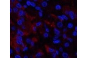Immunofluorescence analysis of Human stomach tissue using RUNX2 Polyclonal Antibody at dilution of 1:200.