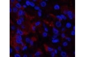 Immunofluorescence analysis of Human stomach tissue using RUNX2 Polyclonal Antibody at dilution of 1:200. (RUNX2 anticorps)