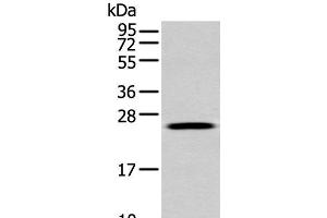Western blot analysis of A549 cell using FGFBP1 Polyclonal Antibody at dilution of 1:350 (FGFBP1 anticorps)