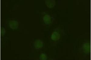 Immunofluorescent staining of HeLa cells using anti-A1AT mouse monoclonal antibody (ABIN2452352). (SERPINA1 anticorps  (AA 26-418))