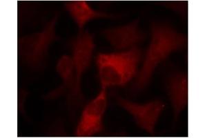 Image no. 3 for anti-Protein Kinase, AMP-Activated, alpha 1 Catalytic Subunit (PRKAA1) (Thr174) antibody (ABIN197410)