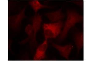 Image no. 3 for anti-Protein Kinase, AMP-Activated, alpha 1 Catalytic Subunit (PRKAA1) (Thr174) antibody (ABIN197410)