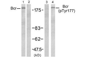 Western blot analysis of extract from A431 ce lls, untreated or treated with EGF (200ng/ml, 5min), using Bcr (Ab-177) antibody (E021197, Lane 1 and 2) and Bcr(phospho-Tyr177) antibody (E011199, Lane 3 and 4). (BCR anticorps  (pTyr177))