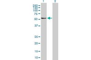 Western Blot analysis of DALRD3 expression in transfected 293T cell line by DALRD3 MaxPab polyclonal antibody. (DALRD3 anticorps  (AA 1-543))