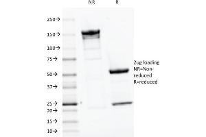 SDS-PAGE Analysis Purified PTH Mouse Monoclonal Antibody (PTH/1175). (PTH anticorps  (AA 32-115))