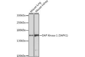 Western blot analysis of extracts of various cell lines, using DAP Kinase 1 (DAP Kinase 1 (D)) Antibody (ABIN6130240, ABIN6139401, ABIN6139402 and ABIN6221411) at 1:1000 dilution. (DAP Kinase 1 anticorps  (AA 1141-1430))