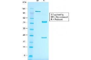 SDS-PAGE Analysis of Purified MART-1 Mouse Recombinant Monoclonal Antibody (rMLANA/788).