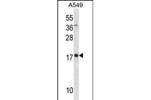 MYL4 anticorps  (N-Term)