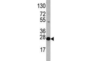 Western blot analysis of EIF4E antibody and HL-60 lysate.