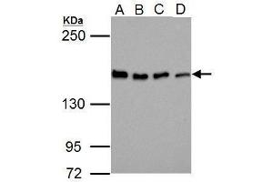 WB Image Sample (30 ug of whole cell lysate)    A: Jurkat   B: Raji   C: K562   D: NCI-H929   5% SDS PAGE    antibody diluted at 1:1000    (BLM anticorps  (C-Term))
