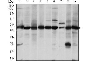 Western Blotting (WB) image for anti-Argininosuccinate Synthase 1 (ASS1) antibody (ABIN1845465) (ASS1 anticorps)